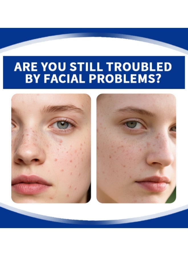 Radiant Acne Treatment Cream Anti Acne Gel Moisturizing For Oily And Acne Prone Skin - Image 4